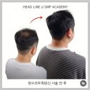 굿모닝헤어샵 | 울산두피문신 실패 후 충격 그잡채