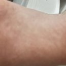 메디레스큐 이미지