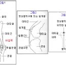 슬개골 탈구에 대하여 이미지