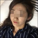 행복플러스약초건강원 | 얼굴여드름 치료 후기 악화되던 피부가 달라진 과정