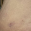 플레저성형외과의원 이미지