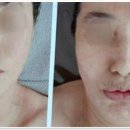 라니아에스테틱 솔직 후기! 피붓결도 체형도 완벽 관리받은 기록이에요
