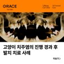그레이스 고양이 심장&치과병원 | 강남고양이전문병원 고양이 치주염의 진행 경과 후 발치