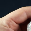 라온바른이치과의원 이미지