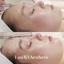 루아에스테틱광주점