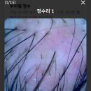 모스테틱광주