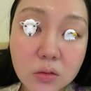 발포락스남양산점 | 수영 갔다 . 접촉성 피부염 -> 주사 피부염 치료 과정, 관리 제품 추천