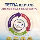 010안경콘택트 | [시흥 안경] 하드렌즈 판매 후기와 장단점