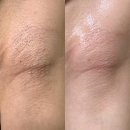 유진칼로핏 | 💍 옥련동 예신원장이 추천하는 웨딩왁싱 부위 총정리!