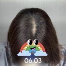 출두대구 | 압구정 SMP :: 출두 청담본점 :: 50대 가르마SMP 3회차 후기 (야간시술 가능🌙)