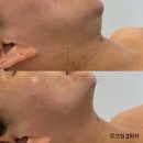 로라운지 이미지