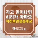 [건강TIP]자고 일어나면 허리가 아픈 척추후관절증후군 이미지