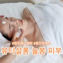 청주 용암동피부관리, 뷰티살롱 늘봄 피부에서 중안부 L커브 리프팅 후기