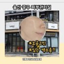 울산 성안동 피부관리실 위크원 모공고민 따끔했던 엑소좀 찐 후기