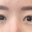 스칼프디자인센터 홍대점 이미지