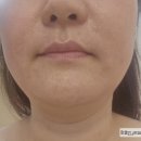 용인피부관리 더블라썸에스테틱 윤곽관리 후기