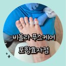 [비올라푸스케어] 포항내성발톱 전문 비올라푸스케어에서 티눈제거 후기