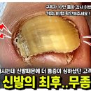 장시간 서서 일하시는데.. 신발때문에 더 통증이 심하셨다고ㅠ 키높이 신발 안돼요! 이미지