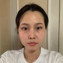 원주 문제성 피부관리 원주 단계동 여우야뷰티