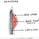 [개&프렌치불독 질병] 이개혈종 ( Hematoma of the Ear Flap ) 이미지