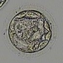 B11-2 | B11. 시험관 2차 동결이식 1차 4일배양 2개이식 후기｜과정·증상·비용 정리