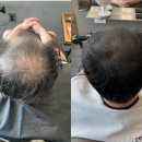 분당 탈모 커버 전문 미용실 / 나한테 맞는 탈모커버 방법은?? (블랭크유 미금점)