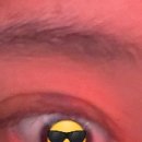 제이유의원 | 제이유의원 피부과 아이라인 문신제거 3차 후기 경과 8일차