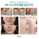 크리스탈 스킨케어