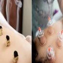 몸바로한의원동탄점 이미지