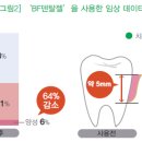 이치덴탈 이미지