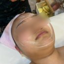 오산 피부관리 &lt;르아떼뷰티&gt; 여드름/민감케어 솔직후기