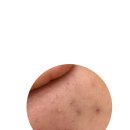오브유에스테틱