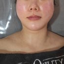 나니뷰티 | 전주피부관리 '뷰티나니' 원모드 리프팅 기기관리 후기