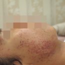 최강한의원 이미지