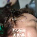 강남피부성형외과 네이버블로그
