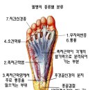 👣 수술로도 해결안된 티눈이 사라졌어요 이미지