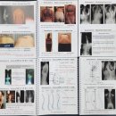 [척추측만증 교정-독일식 슈로스 운동(Schroth Method) 전문가 과정 Basic Course] - 2026년 11월 1일(일 이미지