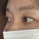 펄미에이트 이미지