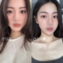 미인치과 | 부산 경락 얼굴 경락 전문 수기미인 후기