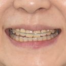 잠실새내역 2번출구 이미지