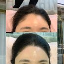 희헤어라인 이미지