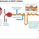 탈수·저혈압 주의…치료 중 수분 공급 필요 SGLT-2 inhibitor 이미지