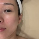 피어나피부샵 | 청량리 피부샵 | 피어나뷰티, 주차와 수분진정관리 후기