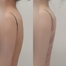 대구 북구 칠성동 승모통증관리 | 눈썹하다 | 더조각에너지테라피후기(관리과정,전후사진)