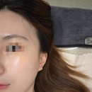 자미한뷰티테라피아라점 | 검단신도시피부관리 아리나뷰티 모공세척테라피 수분키트관리 후기