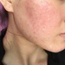 CNP차앤박피부과의원 | 차앤박 CNP 딥 클렌징 퍼펙타 내돈내산 후기