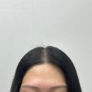 (주)월촌시스템 | 대구 두피페인팅 자연스럽게 채워진 가르마