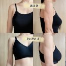 온더핏 | 천안지흡후관리 천안 에스테틱 ‘얼굴핏 더 바디’ 바이오본드 풀고 온 3회차 후기