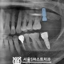 서울에스(S)퍼스트치과의원 이미지
