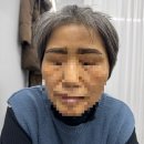[30대 유방암 치료일기] 09 항암 준비(눈썹문신, 머리자르기, 가발상담)